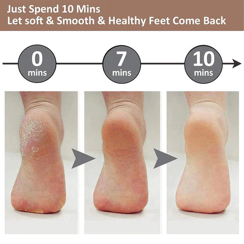 Beautique™ Callus Remover