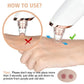 Beautique™Acne Pore & Blackhead Remover Rechargeable